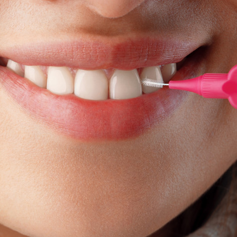 Ершики межзубные Revyline Smart, размер 0 (0,40 мм) розовые, 6 шт. и по всему Казахстану в интернет-магазине Revyline.kz