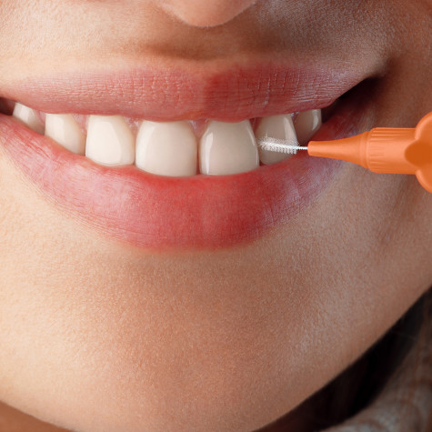 Ершики межзубные Revyline Smart, размер 1 (0,45 мм) оранжевые, 6 шт. и по всему Казахстану в интернет-магазине Revyline.kz